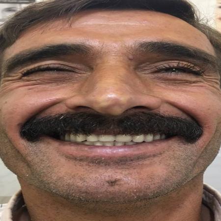 دندانسازی محلات (درمانگاه فتح المبین سپاه )