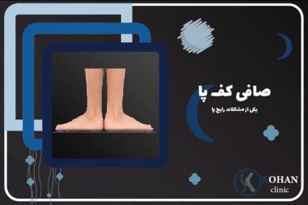 اسکن کف پا و کفی طبی