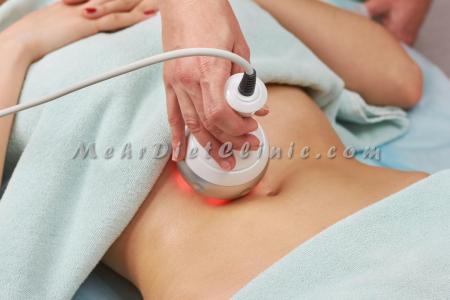 چربی سوزی شکم و پهلو با دستگاه لاغری چربی شکن