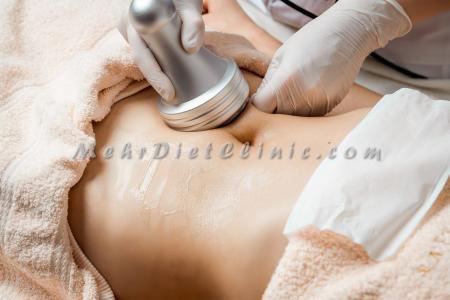 دستگاه لاغری و چربی سوزی شکم بعد از زایمان