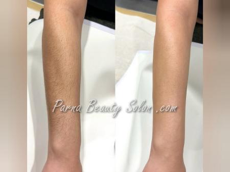 سالن اپیلاسیون کل بدن